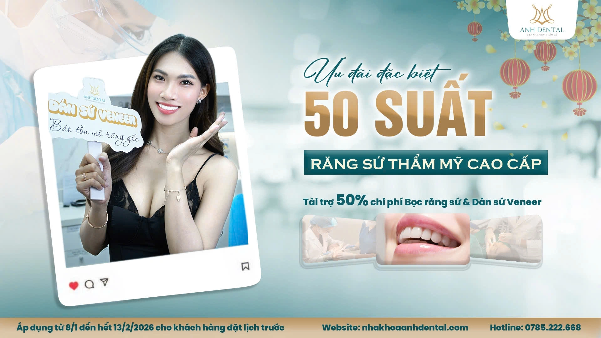 ưu đãi răng sứ thẩm mỹ