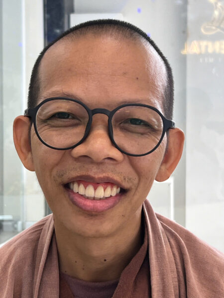 Su-thay-gan-rang-implant