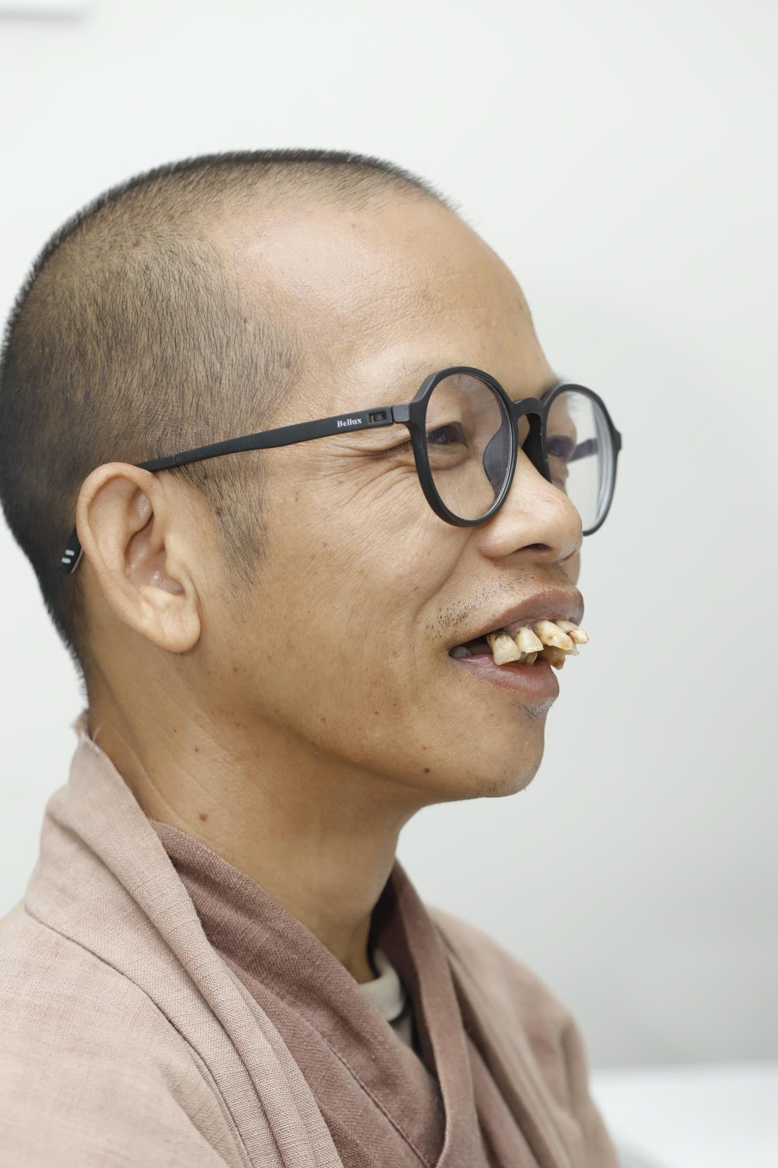 ảnh thầy trước khi làm răng