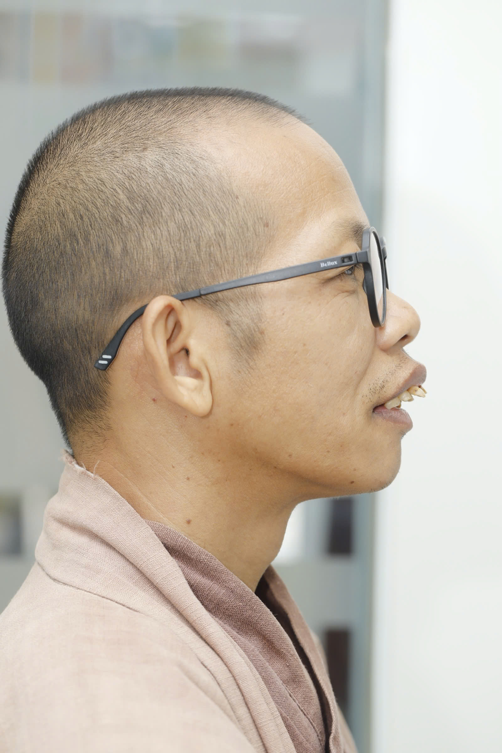 anh-thay-truoc-khi-lam-rang-4