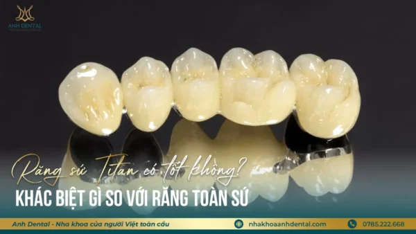 răng sứ titan