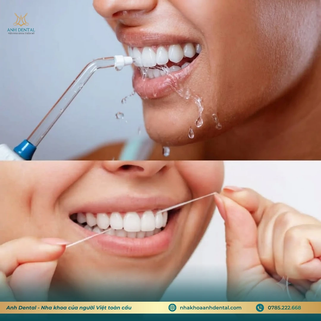 Chăm sóc răng sau khi mài răng bọc sứ