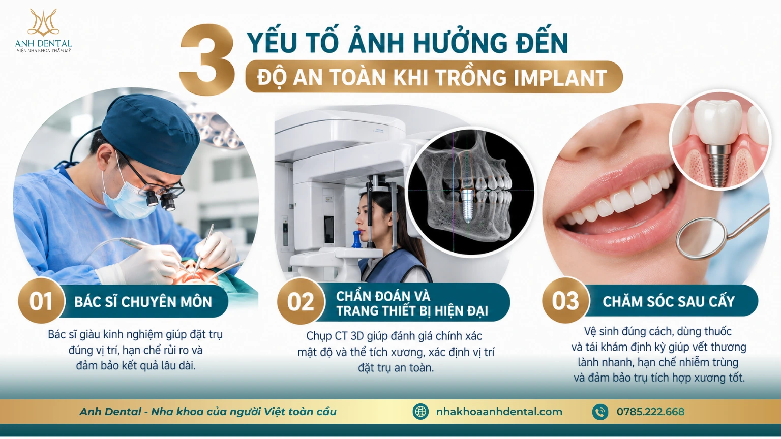 yếu tố ảnh hưởng đến độ an toàn khi trồng răng