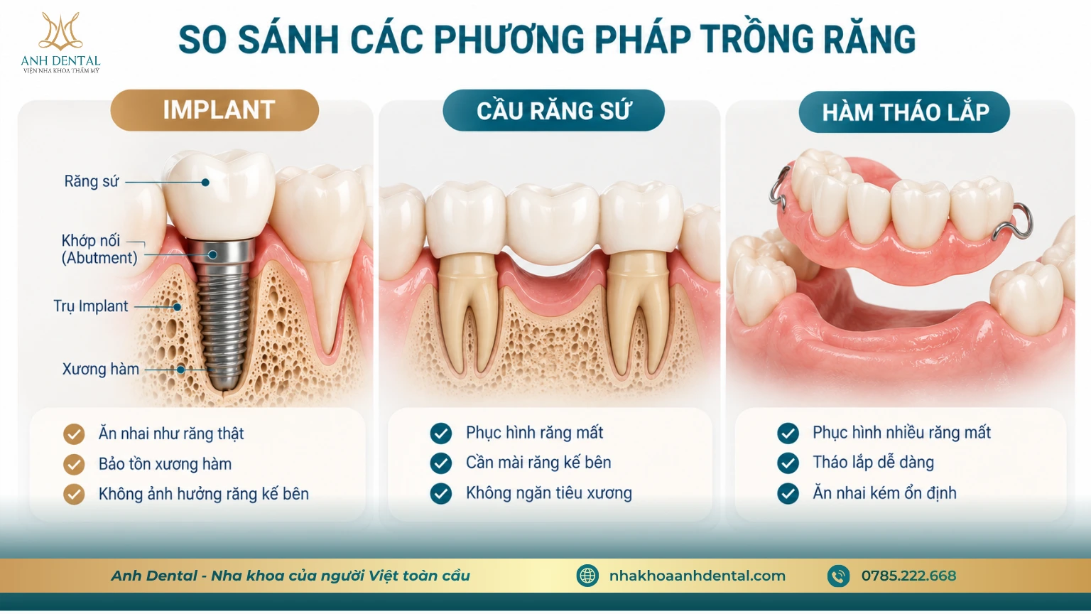 có nên trồng răng implant không